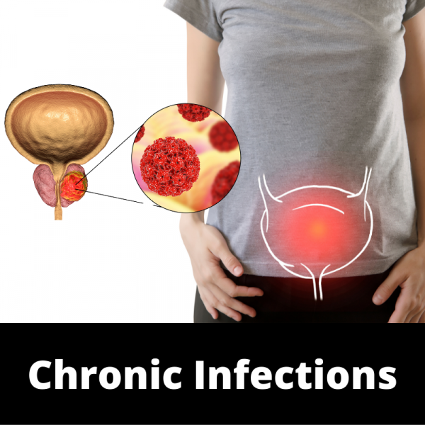 Main - Bladder - Subcategories Chronic Infections - Ailments Images