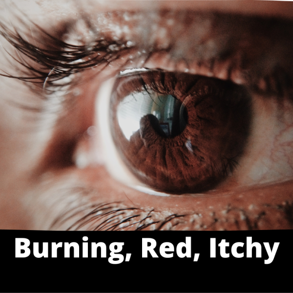 Ailments Images - Category - Eyes - Burning, Red, Itchy