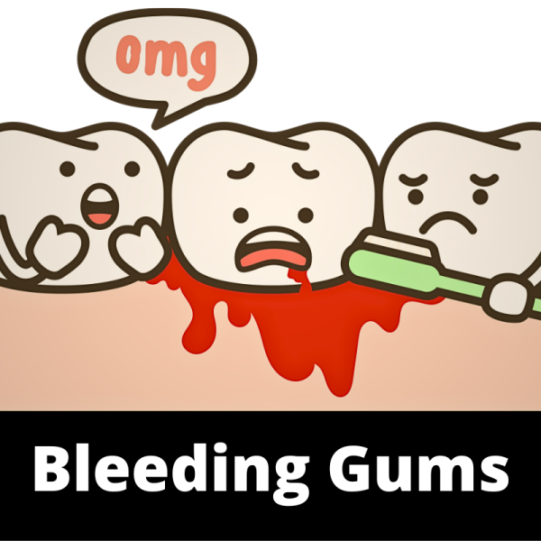 Bleeding Gums - Mouth - Ailments Images - Chinese Herbs