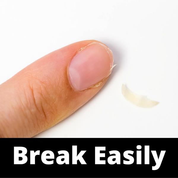 Break Easily - Nails Subcategory - Ailments Images - Chinese Herbs