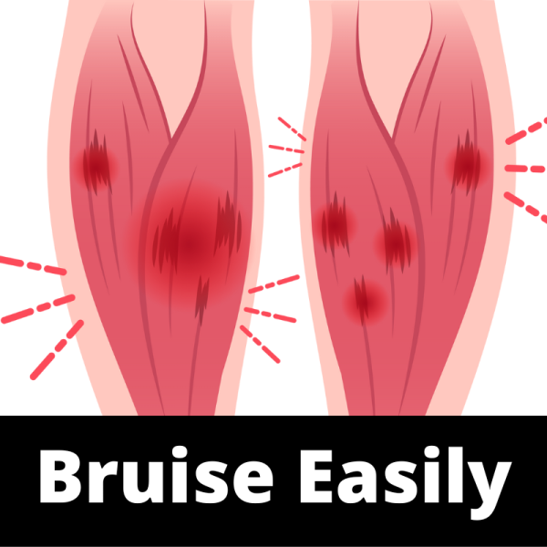 Bruise Easily - Ailments Images - Chinese Herbs