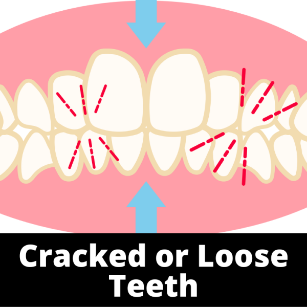 Cracked or Loose Teeth - Mouth - Ailments Images - Chinese Herbs
