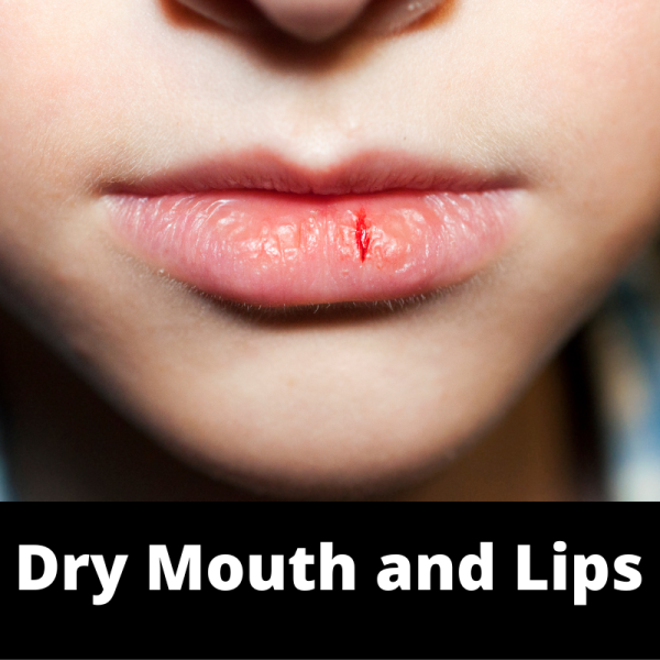 Dry Mouth and Lips - Mouth - Ailments Images - Chinese Herbs