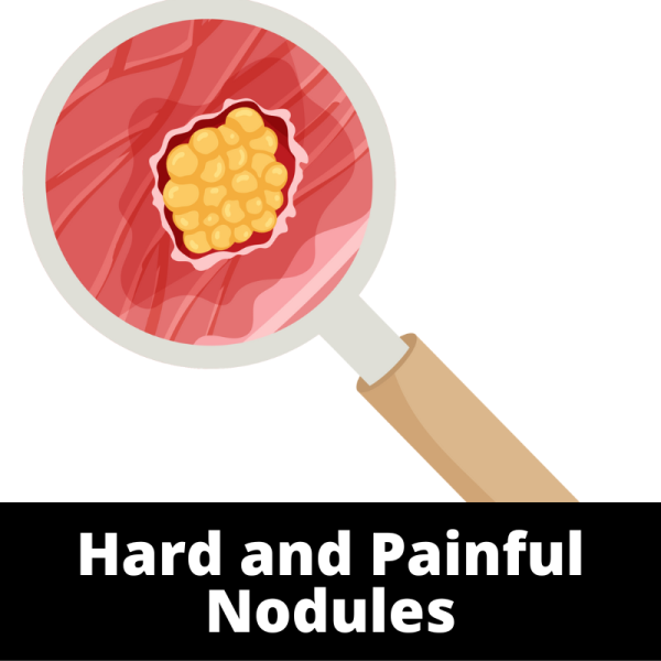Hard and Painful Nodules - Ailments Images - Chinese Herbs