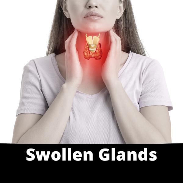 Swollen Glands - Sub Categories - Glands -Ailments Images