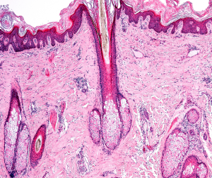 Hair Follicles Microscopic Image 